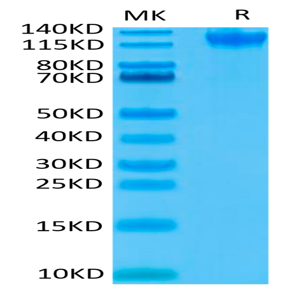 Human Semaphorin 4D/SEMA4D/CD100 Protein (SEM-HM44D)