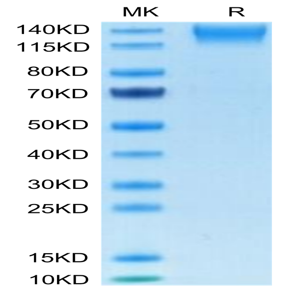 Human SEZ6L2 Protein (SEZ-HM1L2)