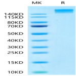 Human SEZ6 Protein (SEZ-HM206)
