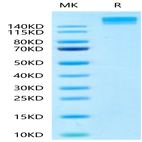 Human SEZ6 Protein (SEZ-HM206)