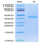 Human SFRP1/SARP2 Protein BP004158 Syd Labs