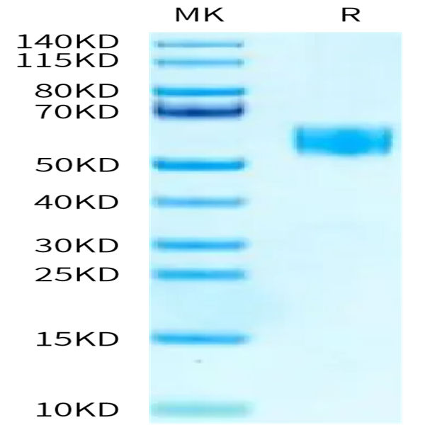 Human SIGIRR Protein (SGR-HM201)