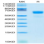 Human SG3/Secretogranin 3 Protein (SGS-HM101)