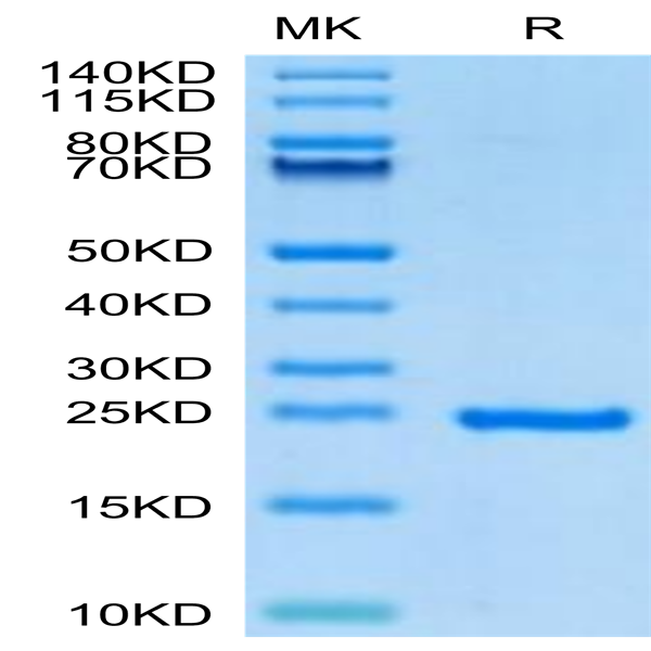 Human Sonic Hedgehog (Shh) Protein (SHH-HE001)