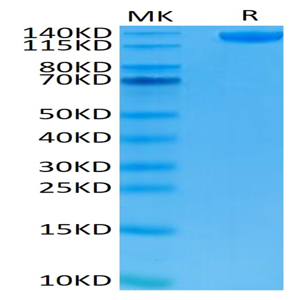 Human Siglec-2/CD22 Protein (SIG-HM222)