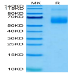 Human Siglec-6/CD327 Protein (SIG-HM406)