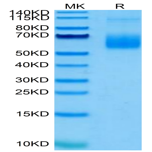 Human Siglec-6/CD327 Protein (SIG-HM406)