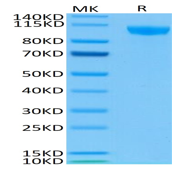 Biotinylated Human Siglec-2/CD22 Protein (SIG-HM412B)