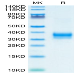 Mouse Siglec-15/CD33L3 Protein BP005394 Syd Labs