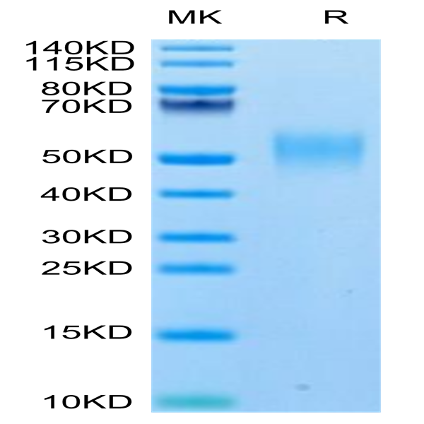 Biotinylated Human SLAMF1/SLAM/CD150 Protein (SLA-HM4MFB)