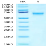Human SMOC1 Protein BP003225 Syd Labs