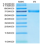 Human SLAMF7/CRACC/CD319 Protein (SMF-HM207)