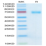 Human SLAMF7/CRACC/CD319 Protein (SMF-HM307)