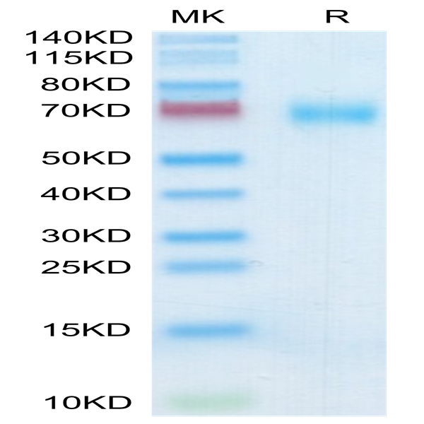 Human SLAMF7/CRACC/CD319 Protein (SMF-HM307)