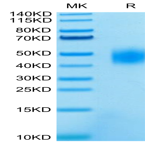 Human SLAMF7/CRACC/CD319 Protein (SMF-HM407)