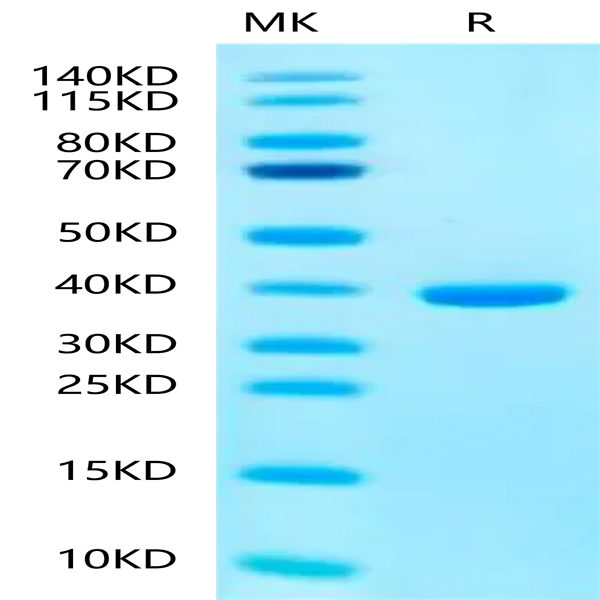 Human SMR3B Protein (SMR-HM33B)