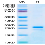 Human SP17 Protein BP003552 Syd Labs