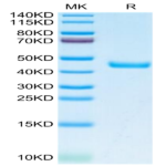 Human SPARC Protein (SPA-HM101)