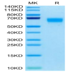 Cynomolgus SERPINF2/A2AP Protein (SPF-CM101)