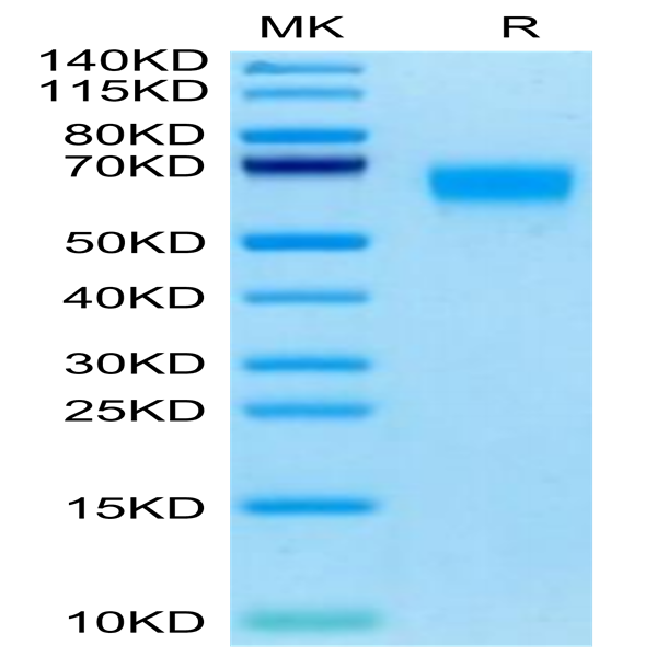 Cynomolgus SERPINF2/A2AP Protein (SPF-CM101)