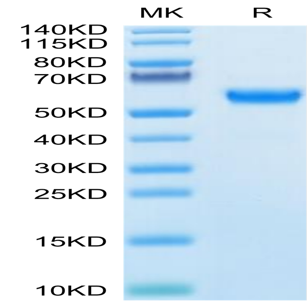 Human SPP1/OPN Protein (SPP-HM101)