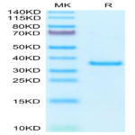 Human SFRP2 Protein BP004599 Syd Labs