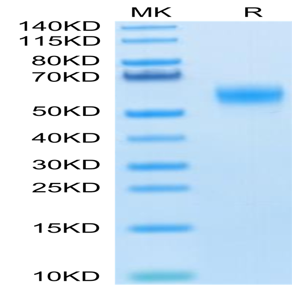 Human SIRP alpha V6 Protein (SRP-HM4V6)