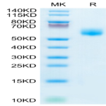 Human IL-1RL1/ST2 Protein (ST2-HM1L1)