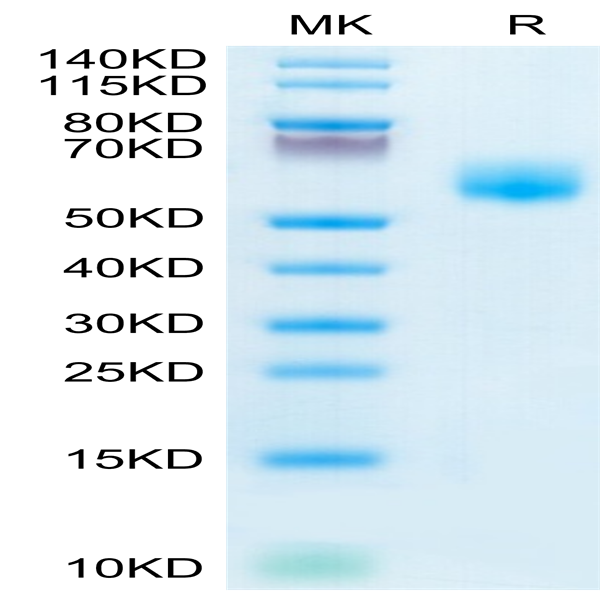Human IL-1RL1/ST2 Protein (ST2-HM1L1)