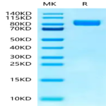 Human IL-1RL1/ST2 Protein (ST2-HM2L1)