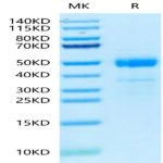 Human ST3GAL4 Protein BP005076 Syd Labs