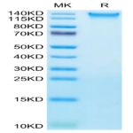 Human TEM1/cd248 Protein (TEM-HM148)