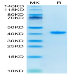 Human TFF1 Protein (TFF-HM201)