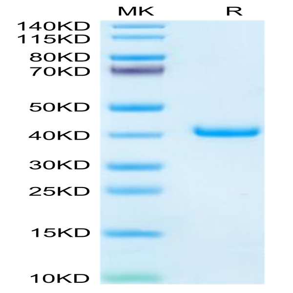 Mouse TFF1 Protein (TFF-MM201)