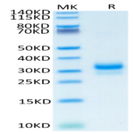 Human TFPI-2 Protein BP004964 Syd Labs