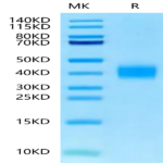 Mouse TFPI-2 Protein BP003251 Syd Labs