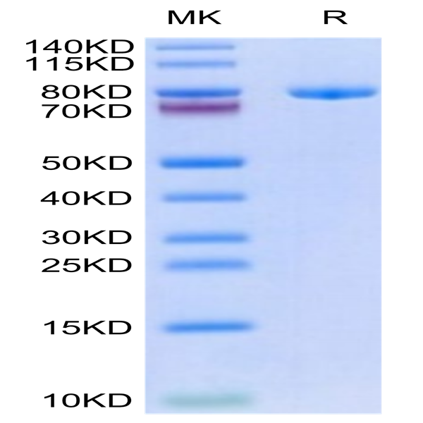 Biotinylated Human Transferrin R/CD71 Protein (TFR-HM401B)