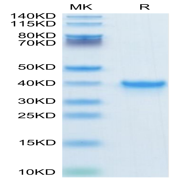 Human TGF-alpha Protein (TGF-HM201)