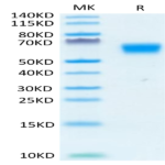 Human TGF-beta RII/TGFBR2 Protein (TGF-HM3R2)