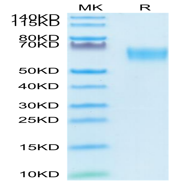 Biotinylated Human TGF-beta RII/TGFBR2 Protein (TGF-HM3R2B)