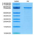 Human TGM2 Protein (TGM-HE102)