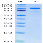 Human TIE1 Protein (TIE-HM101)