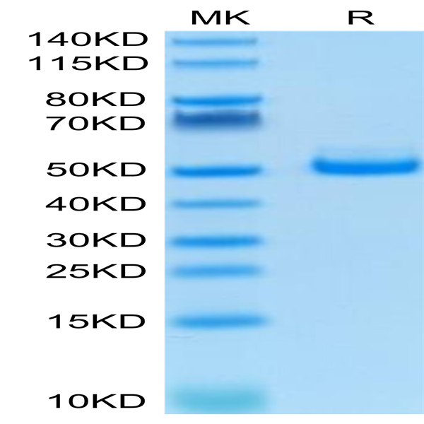 Human TIGIT Protein (TIG-HM210)