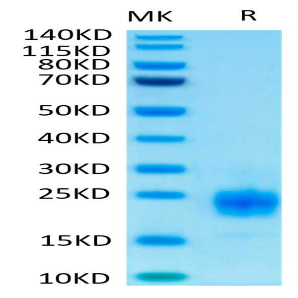 Biotinylated Human TIGIT Protein (TIG-HM410B)