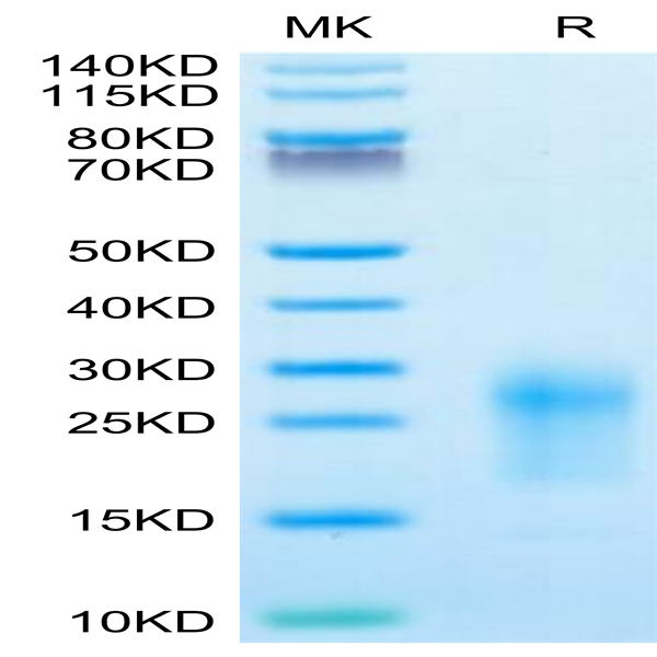 Mouse TIGIT Protein (TIG-MM110)