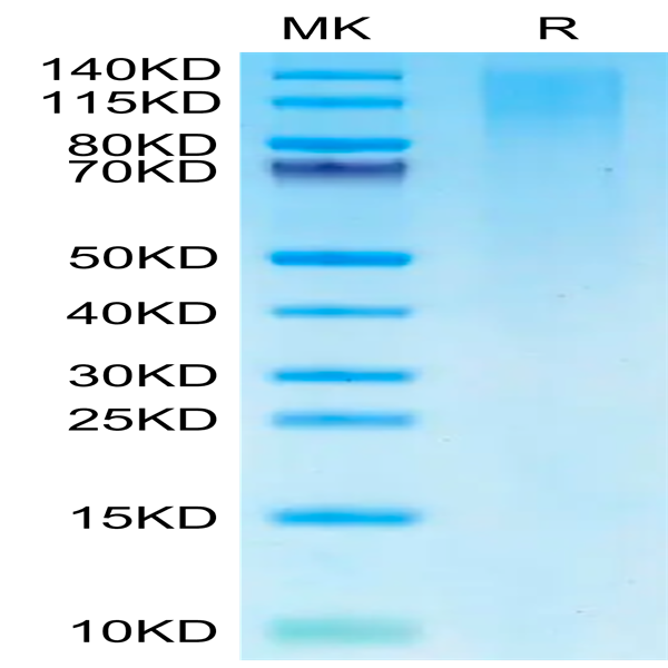 Cynomolgus TIM-1/HAVCR1 Protein (TIM-CM101)