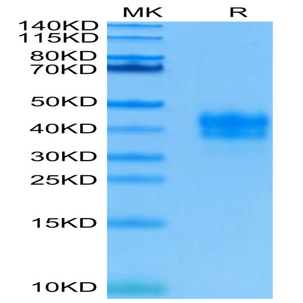 Human TNFR1/CD120a/TNFRSF1A Protein (TNF-HM1R1)