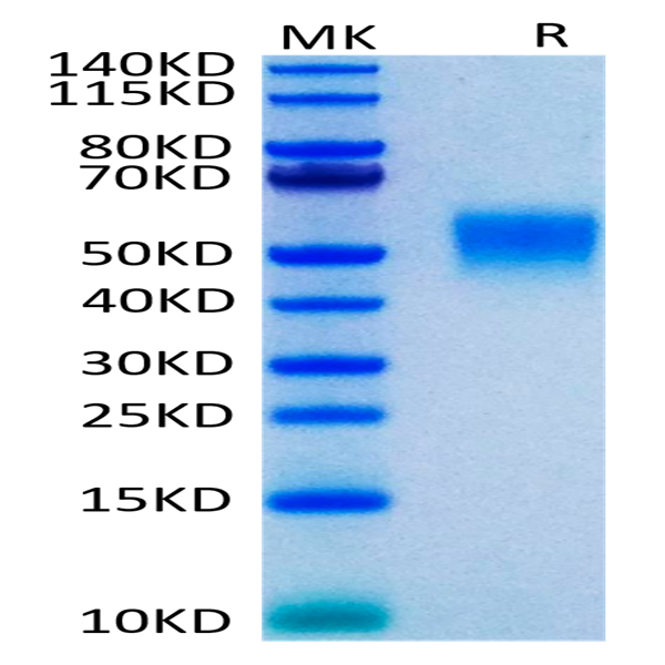 Human TNFR2/CD120b/TNFRSF1B Protein (TNF-HM1R2)