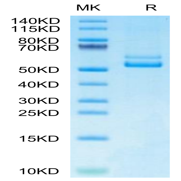 Human TNFSF12/TWEAK Protein (TNF-HM212)