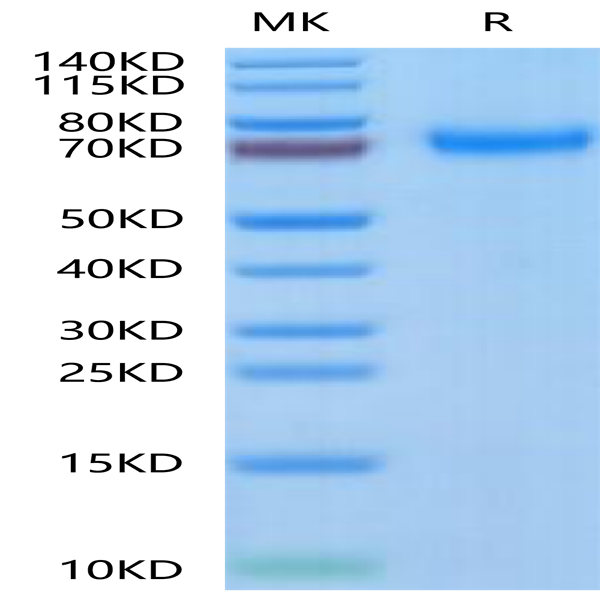 Human TNFR2/CD120b/TNFRSF1B Protein (TNF-HM2R2)